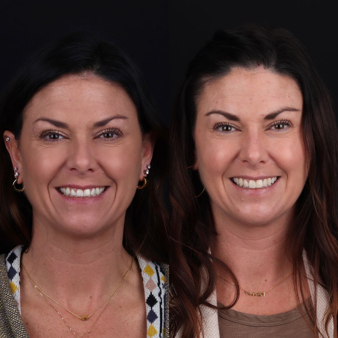 Before and After Image - Slideshow