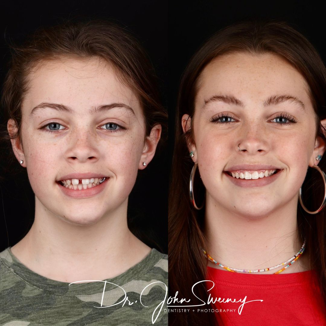 Before and After Image - Slideshow