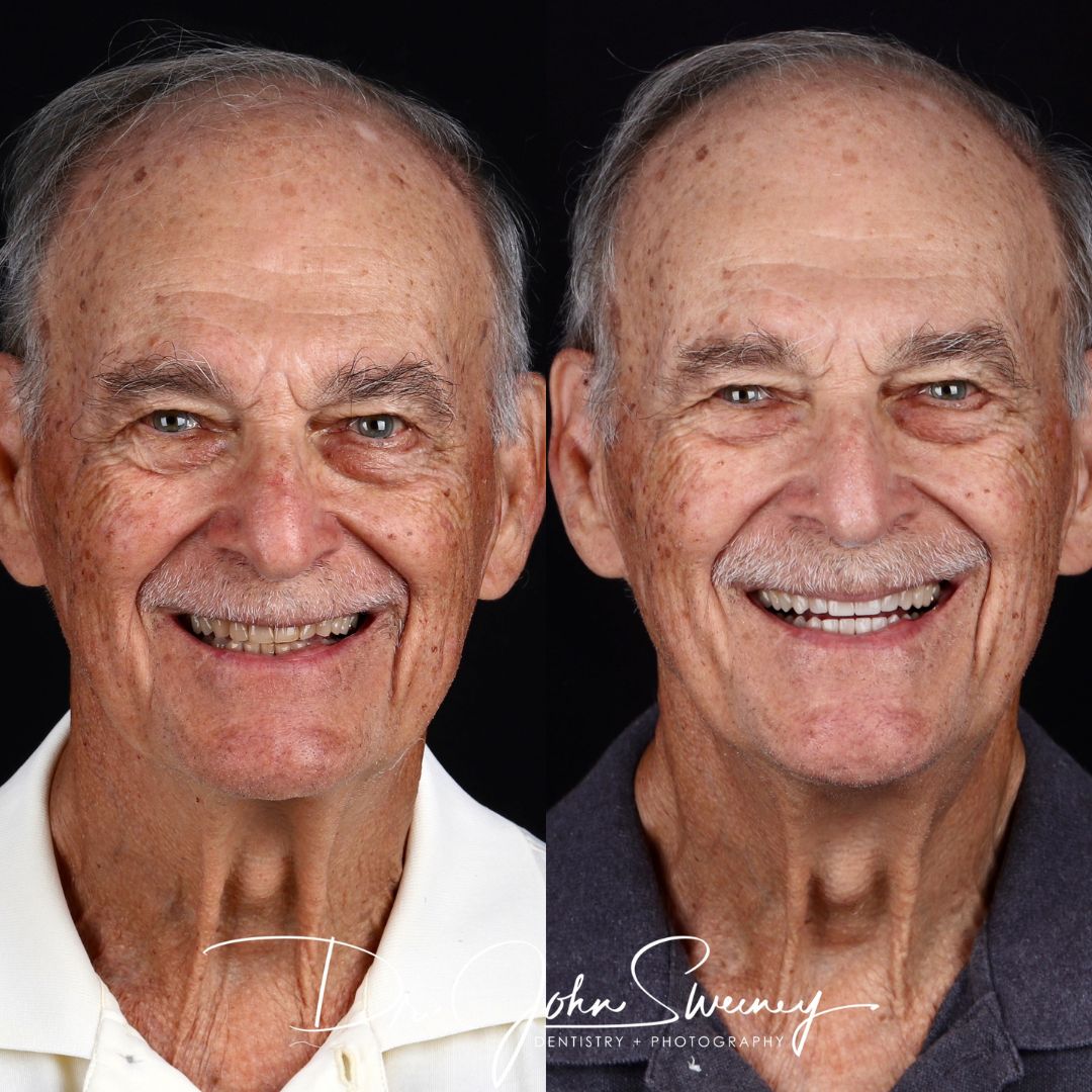 Before and After Image - Slideshow